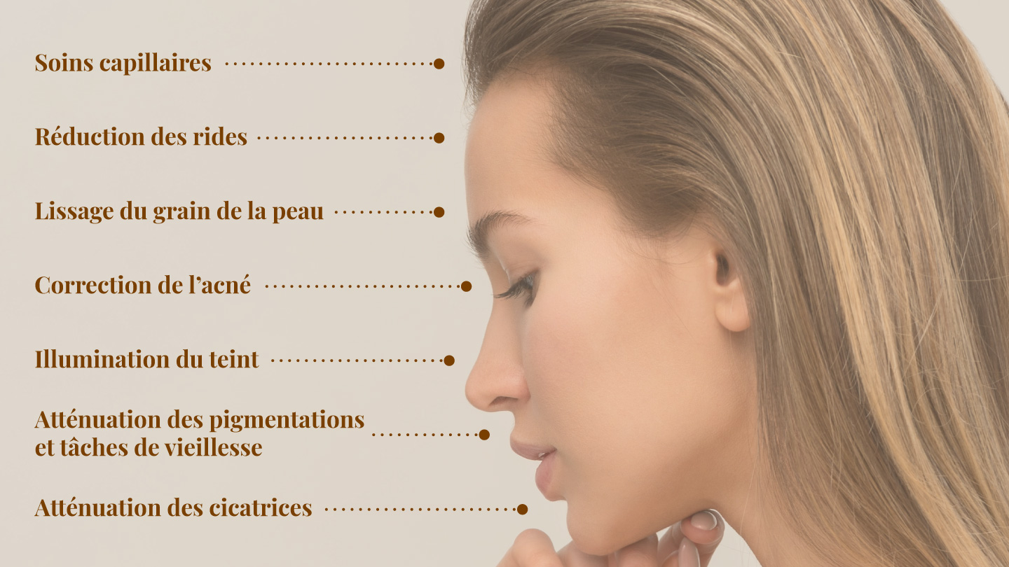 LINAESTHETICS Accueil Resultat 2